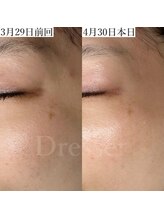 ドレッサー(Dresser)/毛穴・エイジングケアが一緒