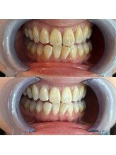 ライトビューティー 池袋店(LightBeauty)/症例写真