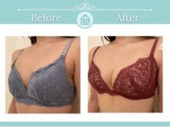 美人バスト 表参道店/【バストアップ/育乳 症例】