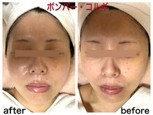 ダルセーニョ/「ダルセーニヨボンバーコルギ」