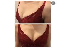 ハチカラット(8carat)/６