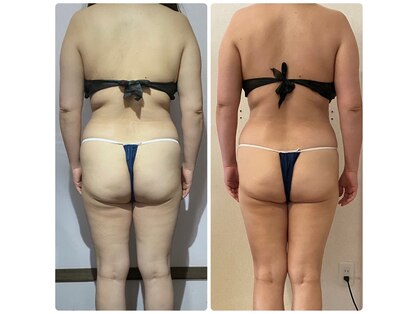 ラビーバ(Ravviva)の写真