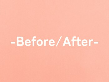 整体こころや/Before/After