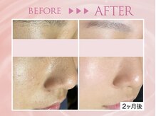 クリアラボ 池袋2nd(Clear Lab)/韓国肌管理&毛穴洗浄専門店