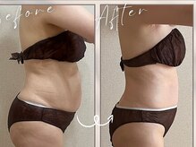 ブルーム(BLOOM)/美BODYオイルトリートメント