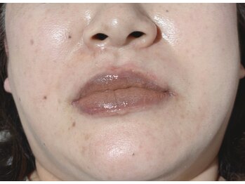 パールブルー(All Perl blue)/コスメリップ