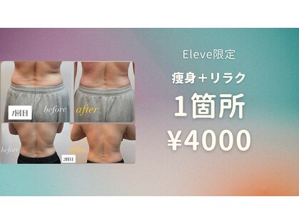 エレーヴ(Eleve)の写真