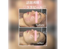 アネラボーテ(Anela beaute)の雰囲気(韓国発【ララピール】正規取扱店♪是非感動体験を!)