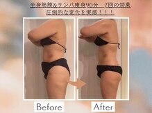 シェルシア(Cielcia)/全身筋膜＆リンパ痩身90分