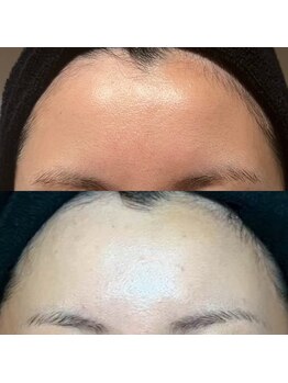 エラ(ella)/最新フォト