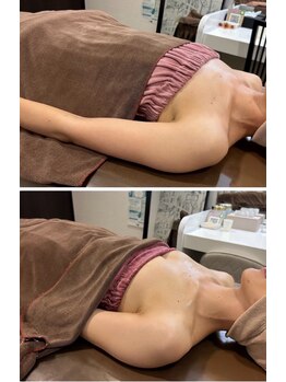 ロココ 豊田店(Rococo)/ビフォーアフター