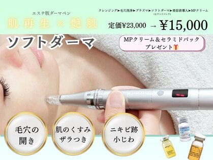 レッド(RED)の写真