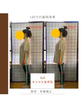 あらかき接骨院/【1回での変化】