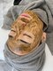 エピズム(EPISMU)の写真/【剥離しないハーブピーリングで肌質改善】ニキビケア+黒ずみ&毛穴の開きを改善!!ぜひお試し下さい☆