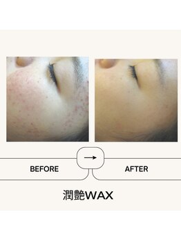 エミア(Emia)/【ツヤ肌×産毛wax脱毛】