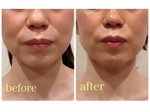 ソワン(soin)/【小顔整顔×エステ】施術効果
