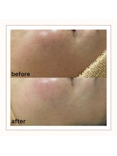 アミュレット(amulette)/インディバエンビロン