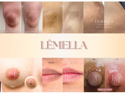 ピュアソル(Puresol)の写真