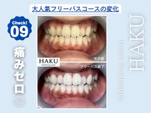 ハク 袋井磐田店(HAKU)/お客様before→after 9