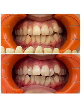 コナホワイトニング 神保町/神保町ホワイトニング