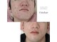 ユニクリア 佐賀(Uniclear)の写真