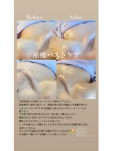 ララルアナ(Lara luana)/産後のバストケア