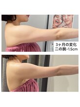 フローフシ∞ 人気No.3 二の腕痩せ