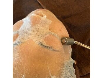 ケアナケア 守谷/毛穴の開きが気になる方はこちら