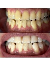 ライトビューティー 池袋店(LightBeauty)/症例写真