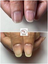 ネイルカフェ ナナ(nailcafe'nana)/自爪育成