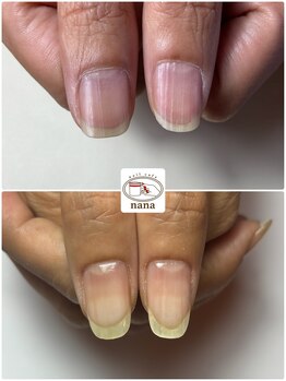 ネイルカフェ ナナ(nailcafe'nana)/自爪育成