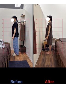 ラムーン(La.Moon)/姿勢改善で痛みの根本改善!