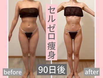 リミー(Re:Me)/40代〇〇さんの変化/産後