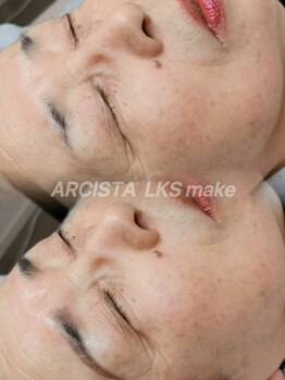 アルシスタ(ARCISTA)/【LKSmake】