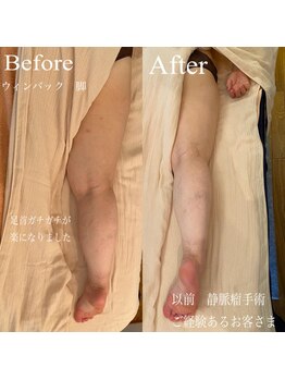 フセヤ &nbsp;エステティックアロマヨガスクール(FUSEYA)/WINBACK 脚　一宮/癒し