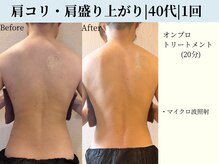 京都フォーエイチ(京都4H)/強い肩コリ・しびれ|マイクロ波