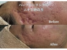 オーシャンハーブ(Ocean Harb)の雰囲気（繰り返す肌荒れ・赤みを根本改善◎/福井/毛穴ニキビケア/眉毛）