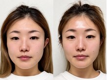 カムロミ 武蔵小杉(kamuromi)の雰囲気（心地いいのにほうれい線が薄くなる小顔矯正◎脳疲労軽減にも！）