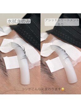 レ プリューム(les plumes)/アシッドトリートメント