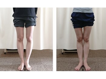 美波整体院 本宮院/O脚のお悩みはお任せ!