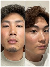 男前サロン/メンズヒゲ脱毛