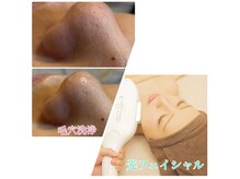 エクラ(E'clat)の雰囲気（肌リセット！毛穴洗浄コース＆肌管理光フェイシャルがおすすめ）