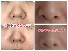 ビューティフルムーン(Beautiful Moon)の雰囲気（大人気☆【小鼻縮小♪】みるみるお鼻が小さくなる◎）