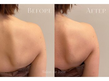 サロンドジョリー(Salon de Jolie)/【ボディウィンバック】