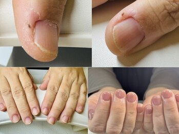 ケアビューティサロン(care beauty salon)/美爪ケア×ジェル
