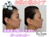 ポールシェリー【お悩み別】フェイシャルケア