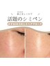 【9月限定】秋こそ始める毛穴洗浄×シミ(20コ)集中ケア¥13200→¥9900