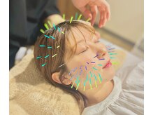 ハリキュア 仙台店(Haricure)