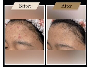 ミルトゥ(myrte)/before→after