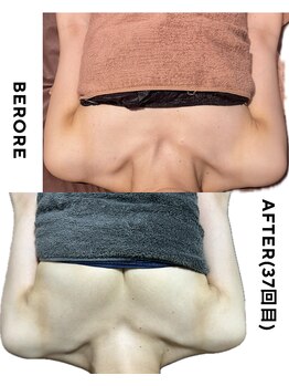 ネイト ワックス(Neit Wax)/バストビフォーアフター◎